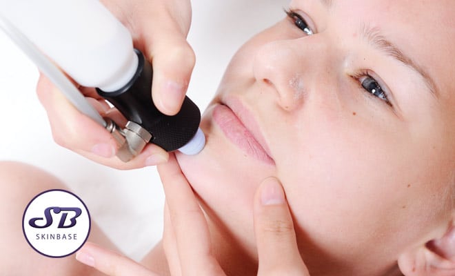 Book your Microdermabrasion in Eastleigh at No1 Beauty Studio