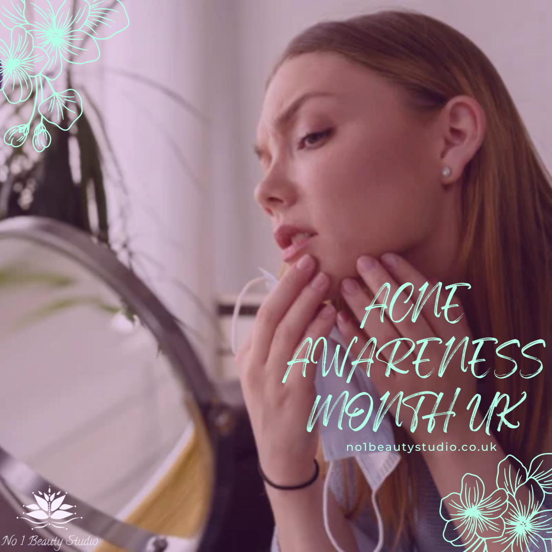 Acne Awareness Month Uk